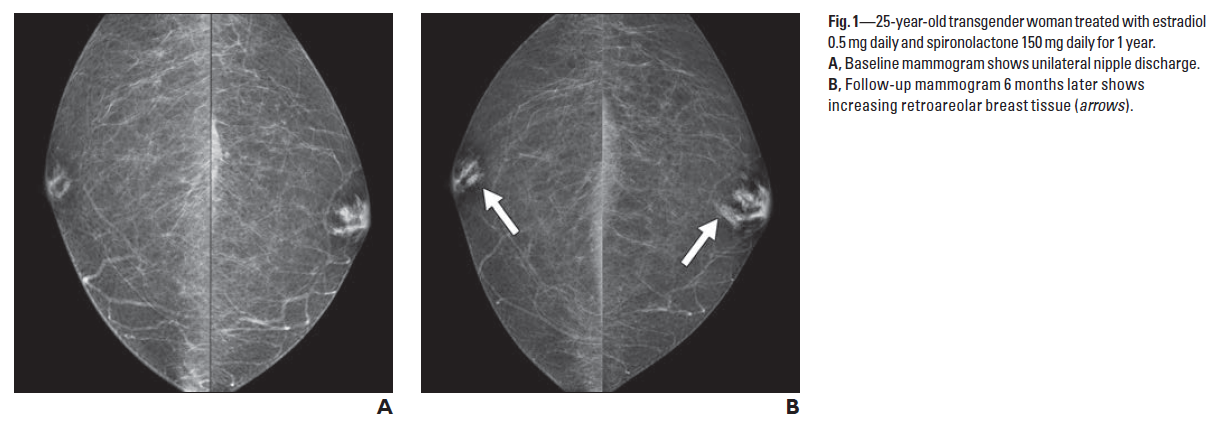 Studies on trans women s breast development Gender Analysis